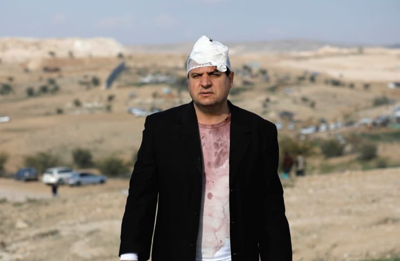JOINT LIST CHAIRMAN Ayman Odeh is seen after he was injured last year during a clash with police in Umm al-Hiran, an unrecognized Beduin village in the Negev. (photo credit: AMIR COHEN/REUTERS)