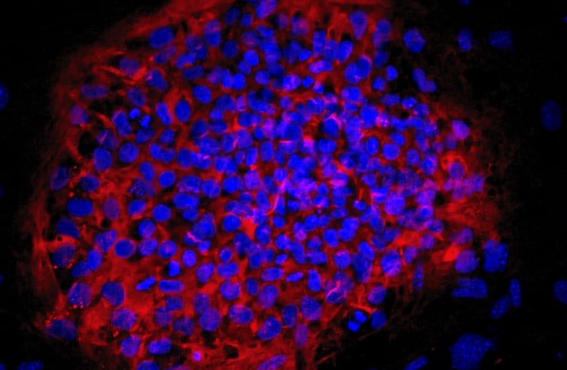 A colony of haploid embryonic stem cells (photo credit: AZRIELI CENTER FOR STEM CELLS AND GENETIC RESEARCH/HEBREW UNIVERSITY OF JERUSALEM)