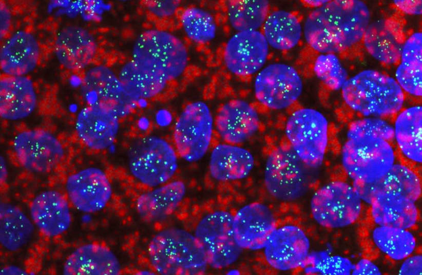 Haploid human embryonic stem cells (photo credit: AZRIELI CENTER FOR STEM CELLS AND GENETIC RESEARCH/HEBREW UNIVERSITY OF JERUSALEM)