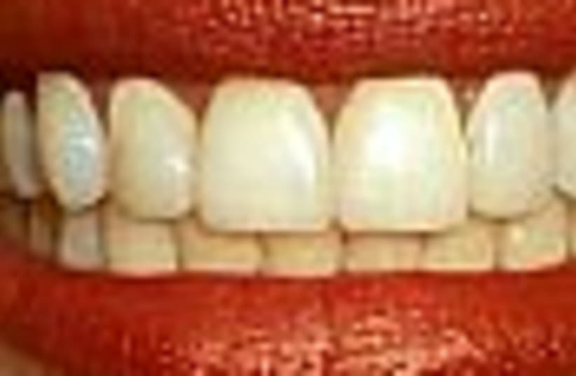 teeth 88 (photo credit: )