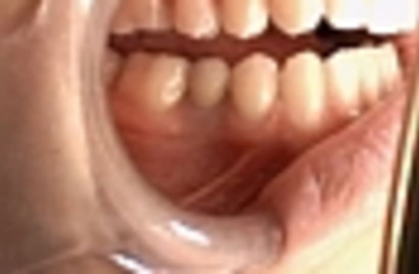 teeth 88 (photo credit: )