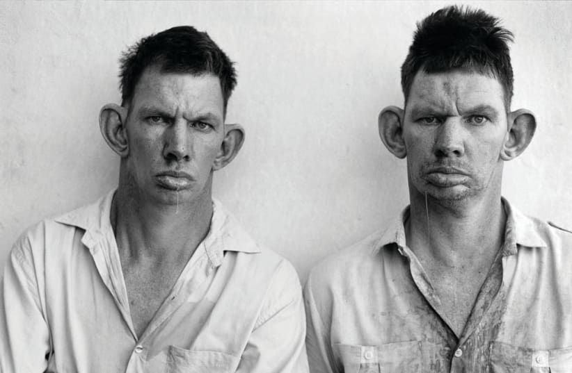 ROGER BALLEN’S ‘Dresie and Casie, twins,’ and ‘Deathbed.’ (photo credit: Courtesy)