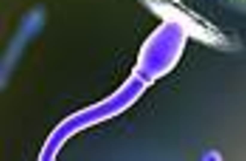sperm 88 (photo credit: )