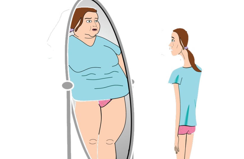 Eating disorders a growing problem in Middle East (photo credit: PIXABAY)