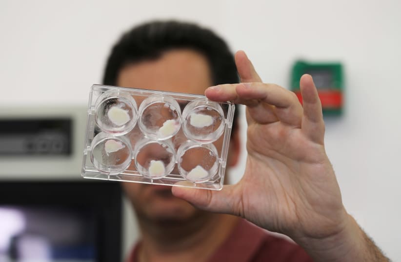 Yaakov Nahmias, founder and chief scientist of Future Meat Technologies, holds laboratory-grown fat samples in his lab in Jerusalem (photo credit: REUTERS)
