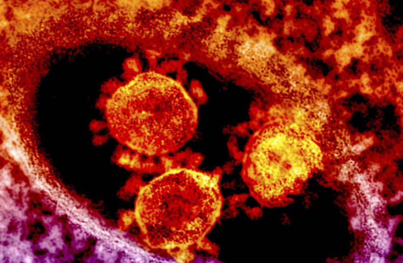 Handout transmission electron micrograph shows particles of the Middle East respiratory syndrome (MERS) coronavirus (photo credit: REUTERS)