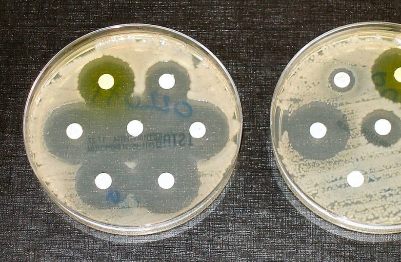 An illustrative picture of antibiotic resistance tests (photo credit: Wikimedia Commons)