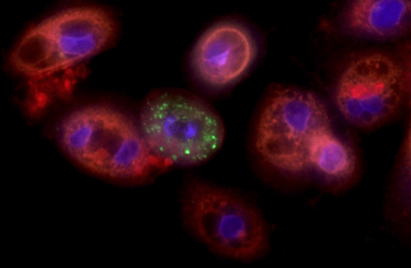 Lung cells infected with coronavirus (photo credit: YAAKOV NAHMIAS)