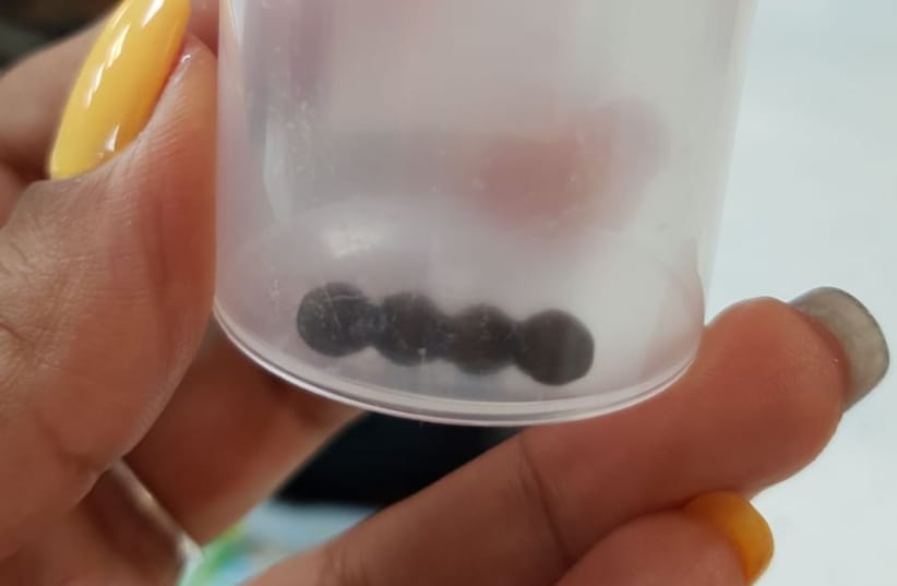 Magnets swallowed by young girl, pulled from stomach of young girl in Hadassah-Ein Kerem (photo credit: HADASSAH SPOKESPERSON)