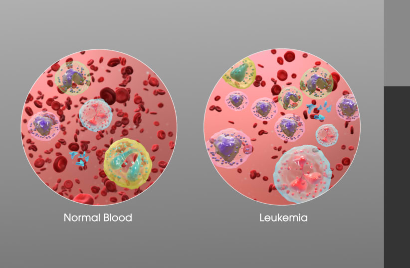  3D Medical Animation still showing an increase in white blood cells of a person suffering from Leukemia. (photo credit: WIKIMEDIA COMMONS/MANU SHARMA/WWW.SCIENTIFICANIMATIONS.COM)