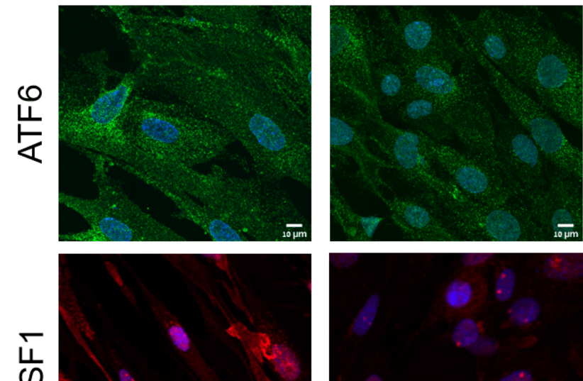 Immuno-fluorescence imaging of young (right) or senescent (left) heat-shocked fibroblasts, where two central transcription factors (TFs), ATF6 (green) and HSF1 (red), were stained. (photo credit: RAMI SHLUSH / TECHNION)