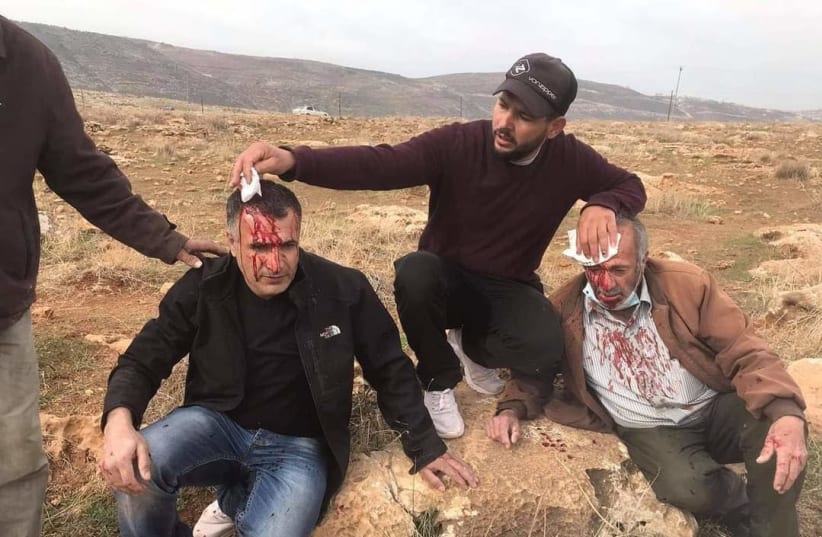 Palestinian farmer and son injured in territorial dispute (photo credit: AQRABA RESIDENT)