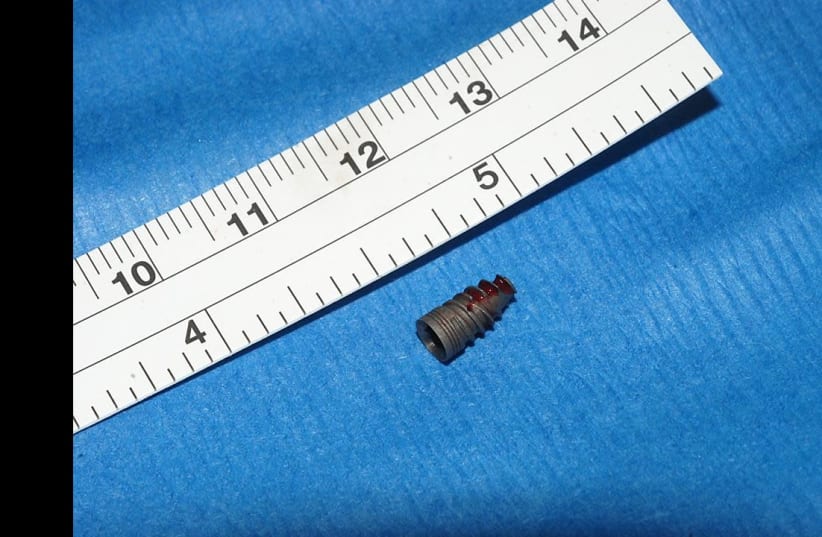 A picture of the dental implant found by  Hadassah Medical Center the  (photo credit: Courtesy)