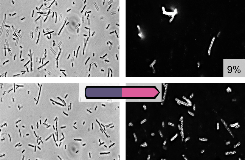 Fluorescence microscope image: The upper image shows the expression of an outer-surface sugar on abacterial culture that expresses all subpopulations, and the two lower images show a bacterial population that expresses only the “pink” subpopulation, where the same outer-surface sugar is more promine (photo credit: TECHNION)