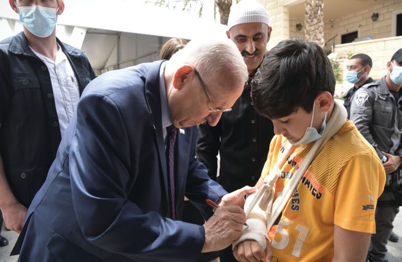 PRESIDENT REUVEN RIVLIN autographs the plaster cast of a Druze boy. (photo credit: KOBI GIDEON/GPO)