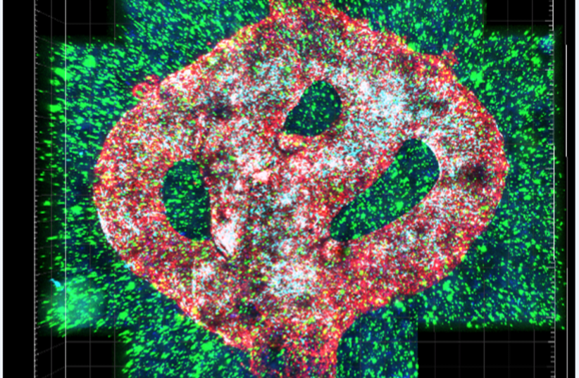  Microscopic image of the 3D-bioprinted glioblastoma model. The bioprinted blood vessels are covered with endothelial cells (red) and pericytes (cyan). The blood vessels are surrounded with a brain-mimicking tissue composed of gliblastoma cells (blue) and the brain microenvironment cells (green).  (photo credit: TEL AVIV UNIVERSITY)