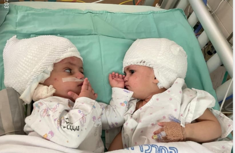 THE FIRST face-to-face meeting of newly separated conjoined twins. The operation to separate them was completed at Soroka-University Medical Center in Beersheba last month. (photo credit: Soroka University Medical Center)