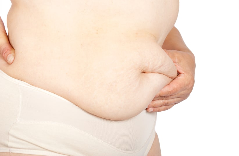  Person with fat stomach (illustrative) (photo credit: INGIMAGE)