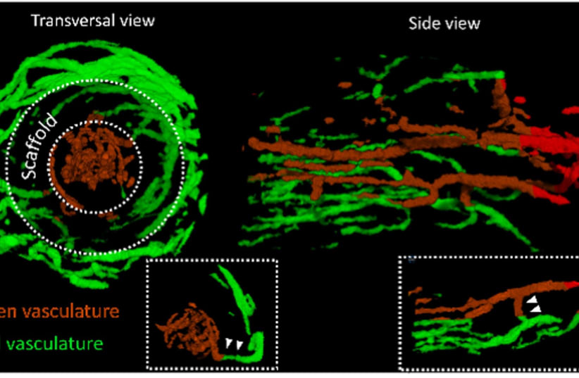 Engineered blood vessels in Technion study. Vascular structures in the scaffold lumen (brown) communicate with vessels located in the surrounding hydrogel (green). (photo credit: Courtesy)