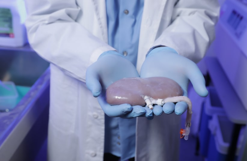 A researcher holds an organ from a pig. (photo credit: COURTESY OF NAYACURE LABS)