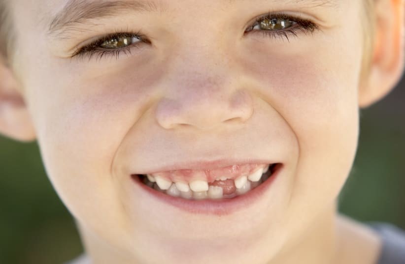  Kid with missing teeth (photo credit: INGIMAGE)