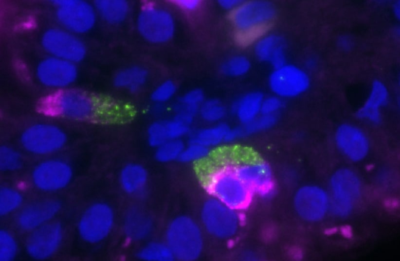 mRNA molecules for making insulin (magenta) are found closer to the cell center, whereas insulin itself (green) accumulates on the outward-facing side of the cell, from where it will be released. (photo credit: WEIZMANN INSTITUTE OF SCIENCE)
