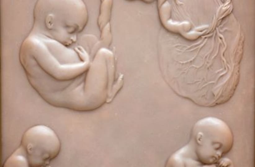 	Development of human embryo at five stages. Contributors: Science Museum, London. (photo credit: SCIENCE MUSEUM, LONDON)