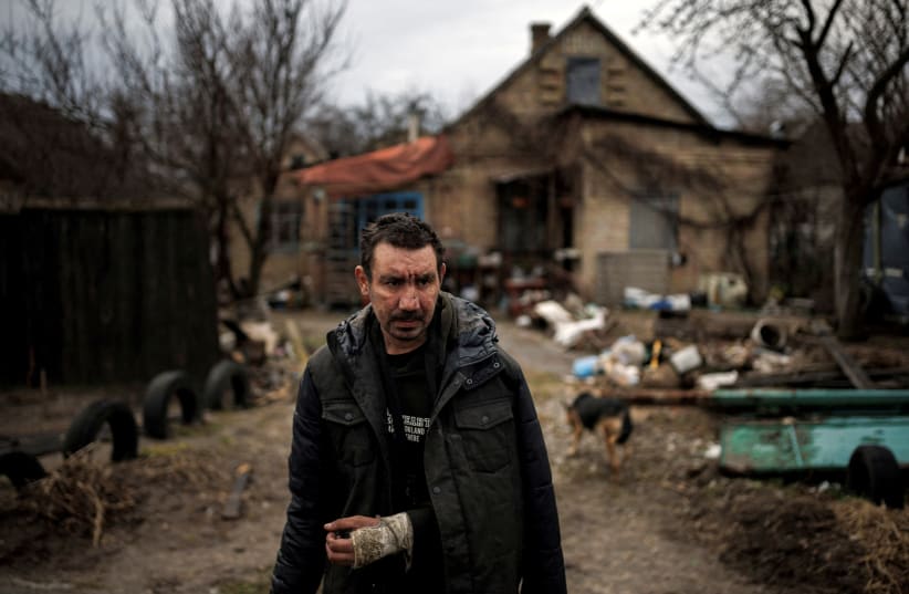 A man, who says Russian soldiers broke his arm, stands outside his house, amid Russia's invasion of Ukraine, in Bucha, in Kyiv region, Ukraine, April 6, 2022. (photo credit: REUTERS/ALKIS KONSTANTINIDIS)