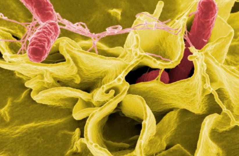  Salmonella bacteria, a common cause of foodborne disease, invade an immune cell. (photo credit: NIAID/WIKIMEDIA COMMONS)