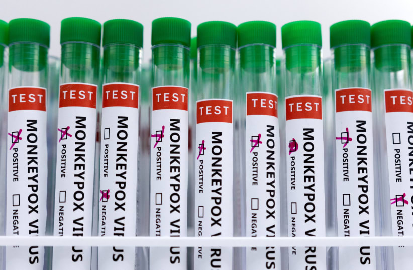 Test tubes labelled "Monkeypox virus positive and negative" are seen in this illustration taken May 23, 2022. (photo credit: REUTERS/DADO RUVIC/ILLUSTRATION)
