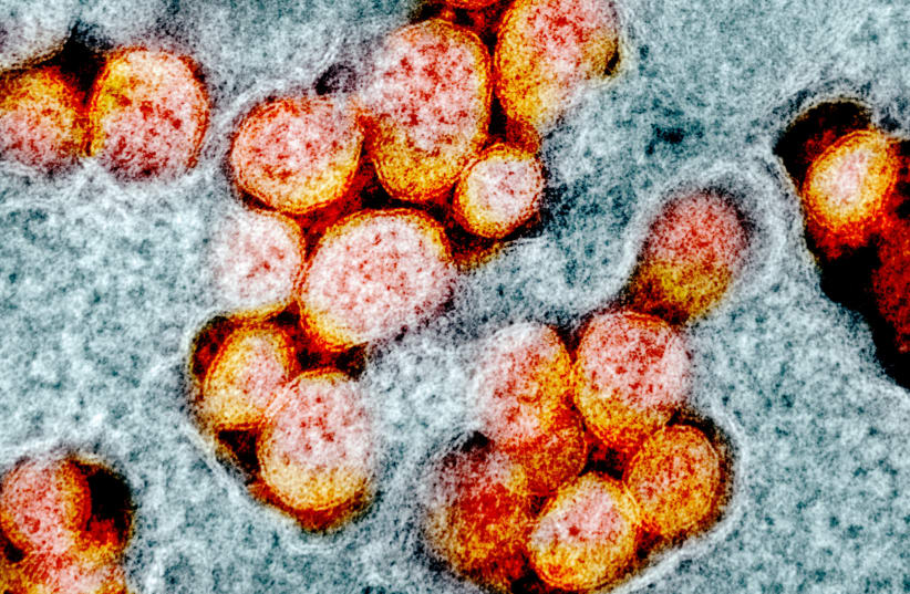 An undated transmission electron micrograph of SARS-CoV-2 virus particles, also known as novel coronavirus, the virus which causes COVID-19, isolated from a patient. (photo credit: NIAID INTEGRATED RESEARCH FACILITY (IRF)/HANDOUT VIA REUTERS)