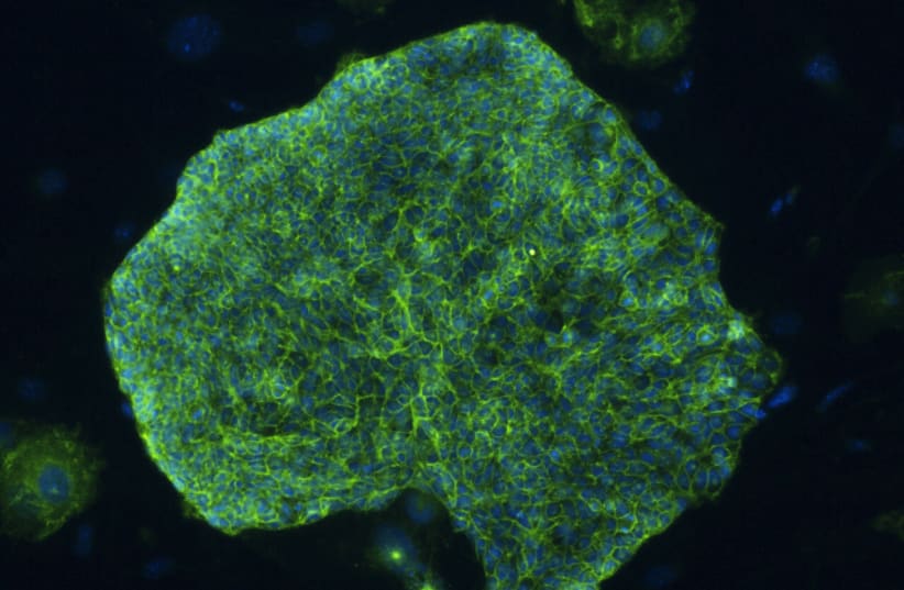   artificial embryonic stem cells (photo credit: HEBREW UNIVERSITY)