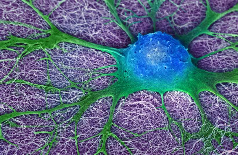  A growing mouse neural stem cell, April 21, 2017.  (photo credit: NIH Image Gallery/Flickr)