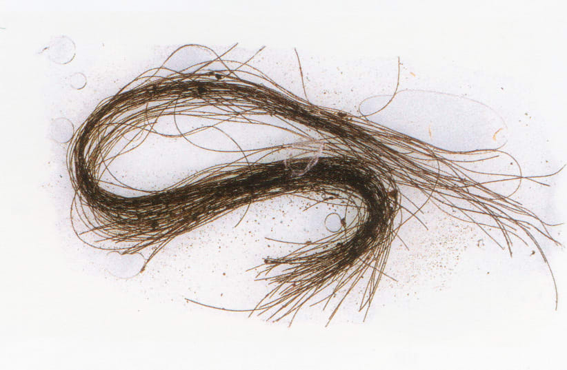 Detail of a hair strand. (photo credit: ASOME-Universitat Autònoma de Barcelona.)