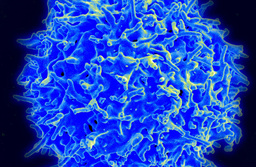  Scanning electron micrograph of a human T lymphocyte (also called a T cell) from the immune system of a healthy donor. (photo credit: NIAID/WIKIMEDIA COMMONS)