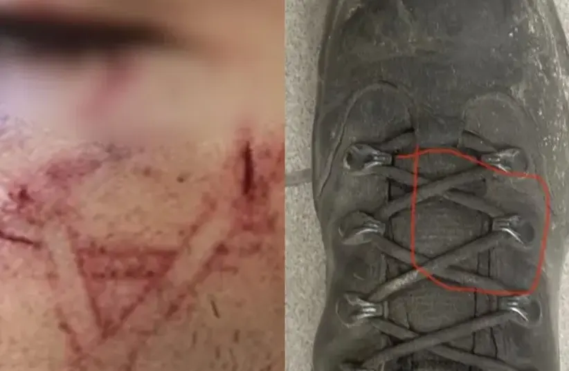  A police officer allegedly used his shoe to brand a Star of David. (photo credit: MAARIV)