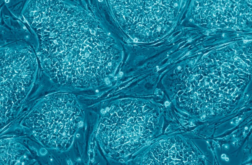  Human pluripotent stem cells. (photo credit: Prof. Nissim Benvenisty)