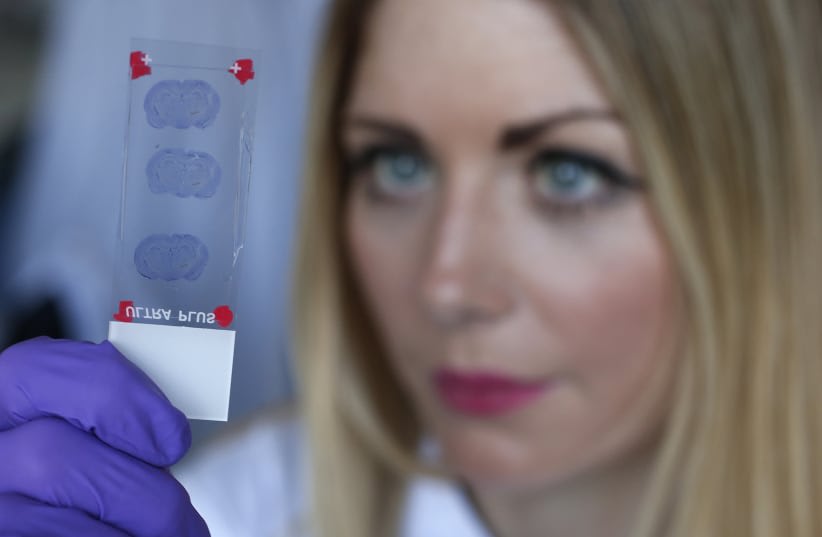  La estudiante de posgrado Katie Bates estudia una rebanada de tejido cerebral parkinsoniano de roedor en el Laboratorio de Nanomedicina de la Facultad de Farmacia de la UCL, en Londres. (photo credit:  REUTERS/Suzanne Plunkett)