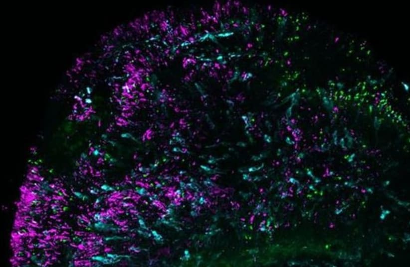  Retinal organoid highlighted with blue cones in cyan and green/red cones in green. Rod cells, essential for low-light and night vision, are indicated in magenta (photo credit: Sarah Hadyniak/Johns Hopkins University)