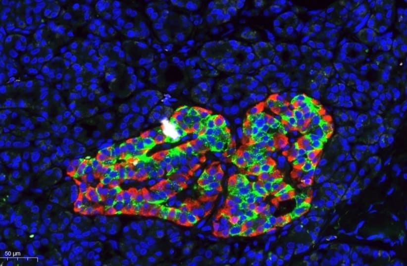  histological image of the human pancreas, stained with antibodies against insulin (green) and glucagon (red), together marking an islet of Langerhans. Blue labels DNA, marking the nuclei of all pancreatic cells. (photo credit: Zeina Drawshy/Dor lab.)
