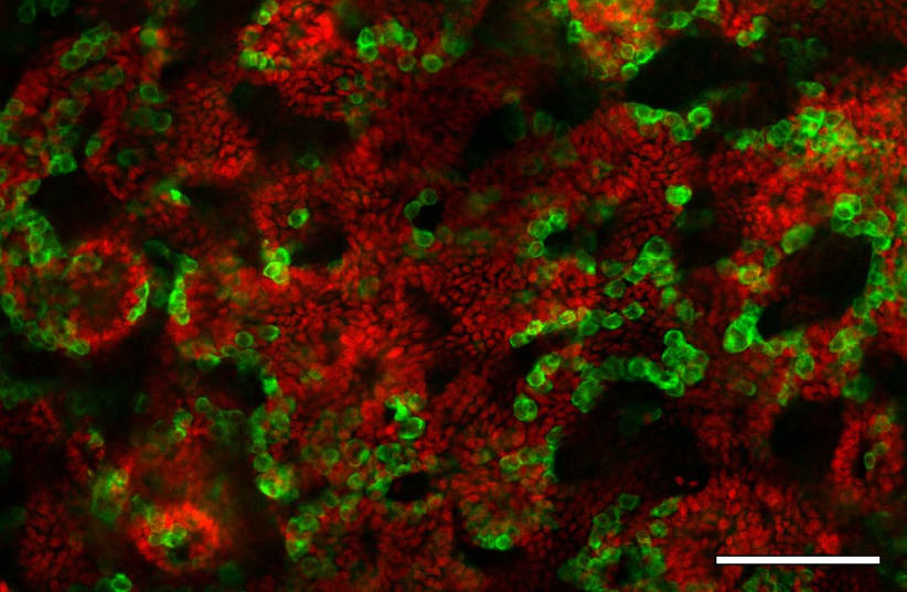  Testicular organoids generated from mice pups and incubated in a dish for 21 days. Sertoli cells, which are the cells responsible for the formation of the tubules in the testicle, appear in red and germ cells, which will produce the sperm cells, appear in green. Germ cells always stay close proximi (photo credit: Aviya Stopel)