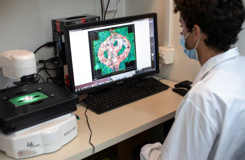  Israeli researcher Eilam Yeini examines a microscope image of a blood vessel tube surrounded by cancer tissues, as part of a brain cancer research that uses patients' cells to make 3D printed models of tumours, at Tel Aviv University, Israel August 17, 2021.  (photo credit: NIR ELIAS/REUTERS)