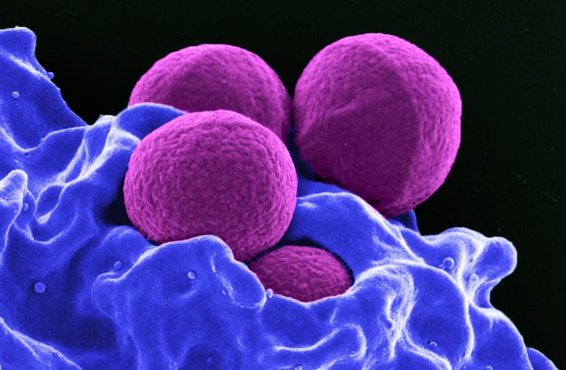 This digitally-colorized scanning electron micrograph depicts four magenta-colored, spherical methicillin-resistant Staphylococcus aureus (MRSA) bacteria in the process of being phagocytized by a blue-colored human white blood cells in this undated handout photo. (photo credit: NATIONAL INSTITUTE OF ALLERGY AND INFECTIOUS DISEASES - NIH/HANDOUT VIA REUTERS)