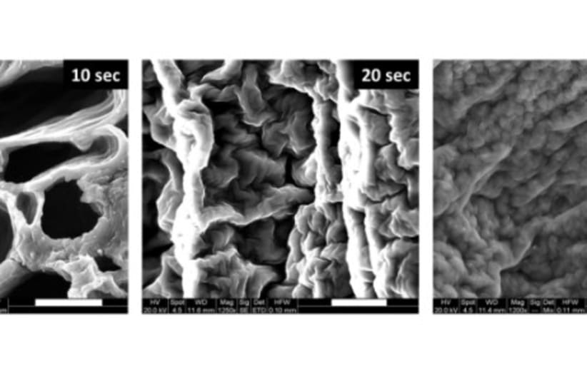 Representative images of the microstructure of formed hydrogels under various US induction durations, taken by a scanning electron microscope. (photo credit: TECHNION-ISRAEL INSTITUTE OF TECHNOLOGY)