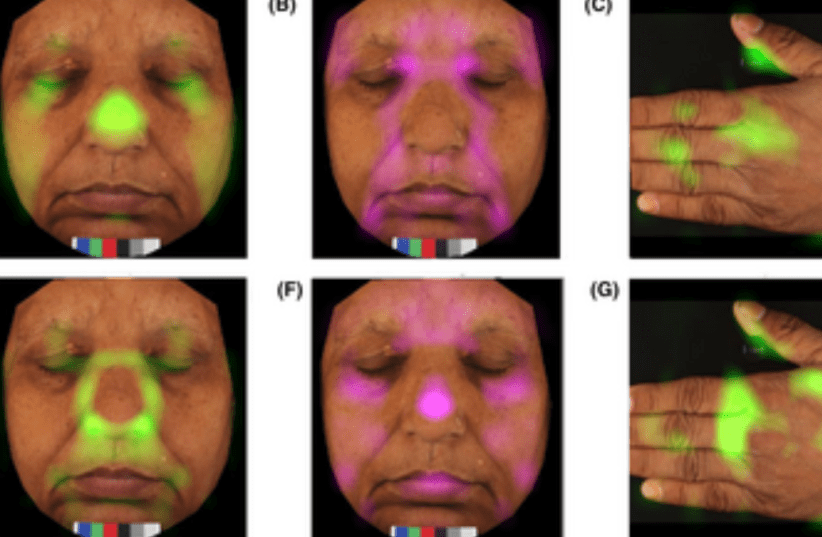  Haut.AI publishes pioneering research: Predicting age with hand images achieves accuracy on par with facial photo. (photo credit: Haut.AI in journal paper)