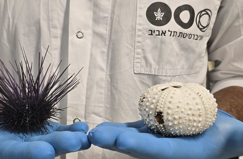  The sea urchin Diadema setosum before (left) and after (right) mortality. The white skeleton is exposed following tissue disintegration and loss of spines. (photo credit: TEL AVIV UNIVERSITY)