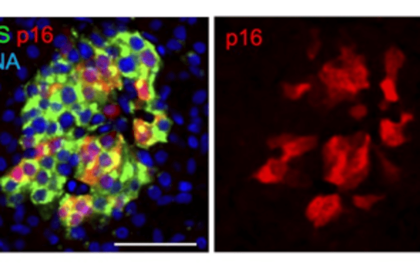  Adult pancreatic islets marking senescent beta cells (photo credit: Nucleic Acid Research)