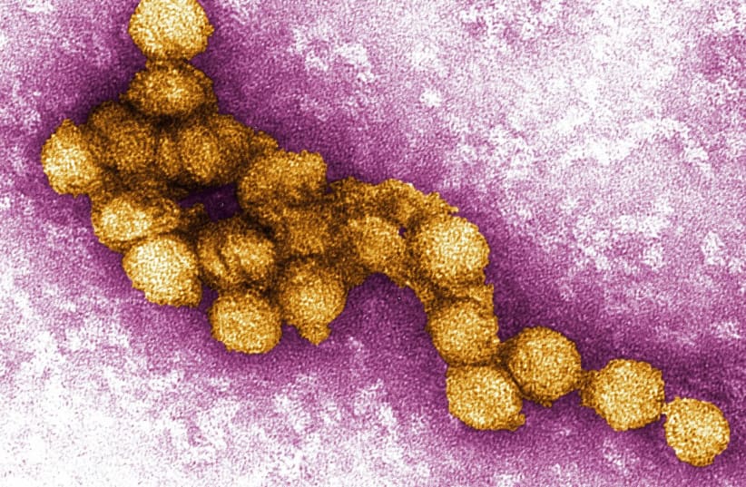  A micrograph of the West Nile Virus (photo credit: Wikimedia Commons)