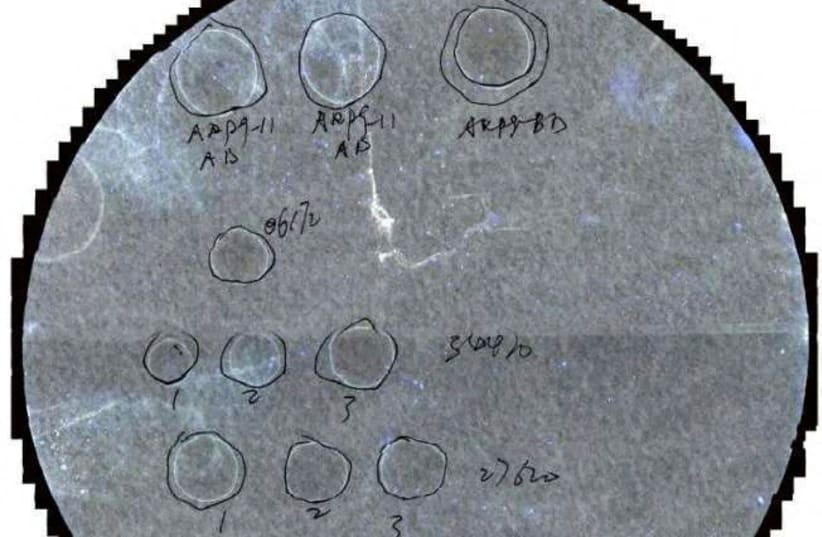 Samples of a pathogen identified by the U.S. Department of Justice as Fusarium graminearum, a fungus it said was classified in scientific literature as a potential agroterrorism weapon, are seen in a criminal complaint by the FBI against Chinese researcher Zunyong Liu and his girlfriend Yunqing Jian (photo credit: U.S. District Court for the Eastern District of Michigan/Handout via REUTERS)