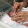 Doctors at Rambam Hospital use a new method for providing respiratory assistance to premature babies.